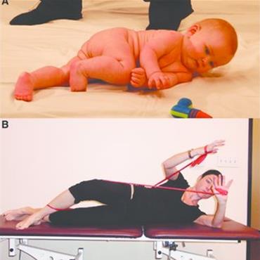 Dynamic Neuromuscular Stabilization